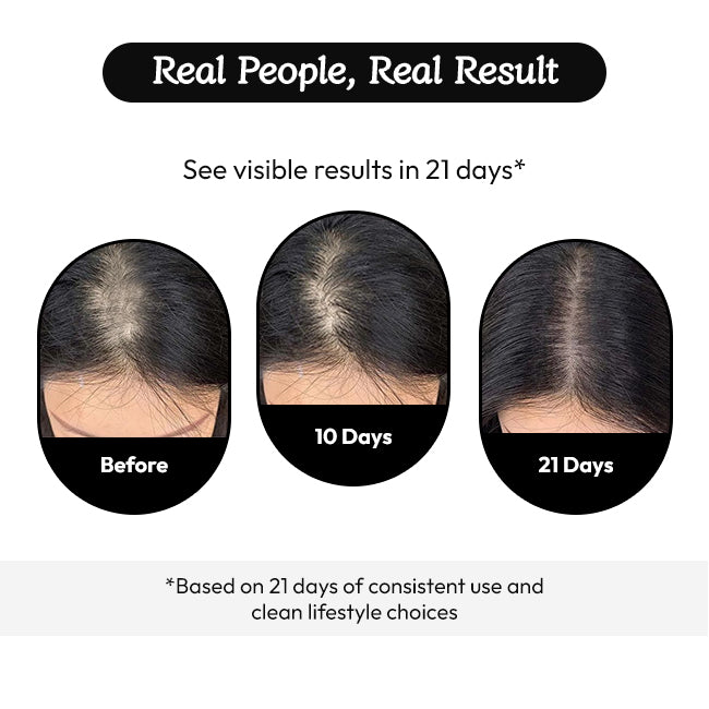 Wayveda Hairfall Control Serum-50ml - Wayveda