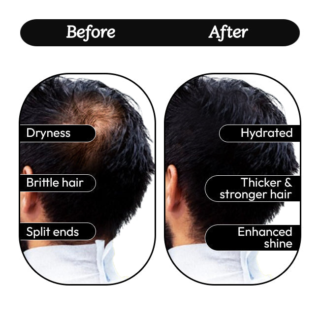 Wayveda Hairfall Control Shampoo-200ml - Wayveda